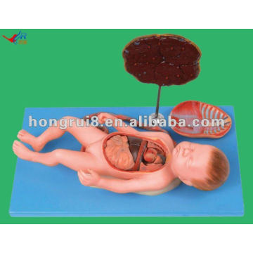 Fetus vif avec visque et placenta, modèle de fœtus